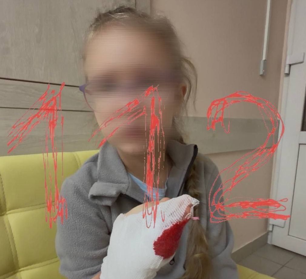 В Бийске возбуждено уголовное дело после сообщения о травме ребенка в детском саду