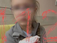 В Бийске возбуждено уголовное дело после сообщения о травме ребенка в детском саду